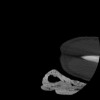 SPORK, NICO - 22.03.1976 - 02.08.2022 - CT obere Extremität - 17:51:17
